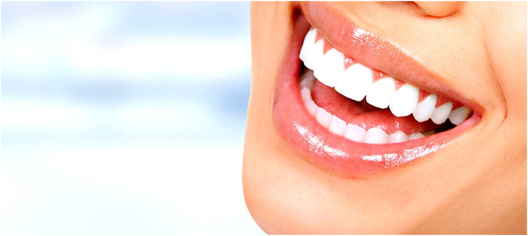 The Pros & Cons of Dental Veneers