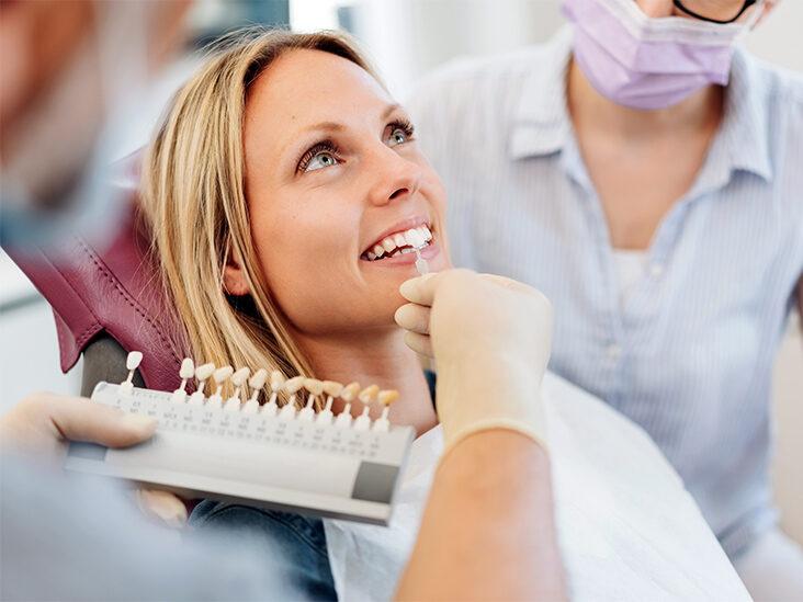 Veneers: Questions You Need to Ask Your Dentist