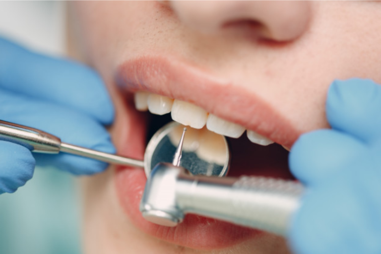 Cosmetic Dental Concerns Considered by Emergency Dentists