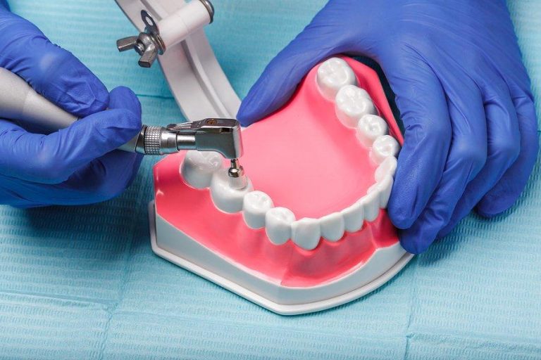 What You Should Know about Endodontic Treatment?